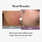 سرم اگزوزم کلاژن صورتی پی دی آر ان ۲۰۰۰ مدی کیوب - Image 2