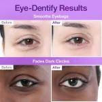 پچ زیر چشم NAD و کلاژن نامبوزین-No.9 NAD+ Collagen Under Eye Patches - Image 2