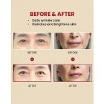 کرم رتینال لیپوزومی ۱% سئول ۱۹۸۸ - Image 2